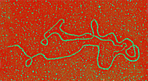 Развёрнутый теломерный участок хромосомы (фото <noindex><a target=_blank href=http://sciencephoto.com>Dr Gopal Murti</a></noindex>).